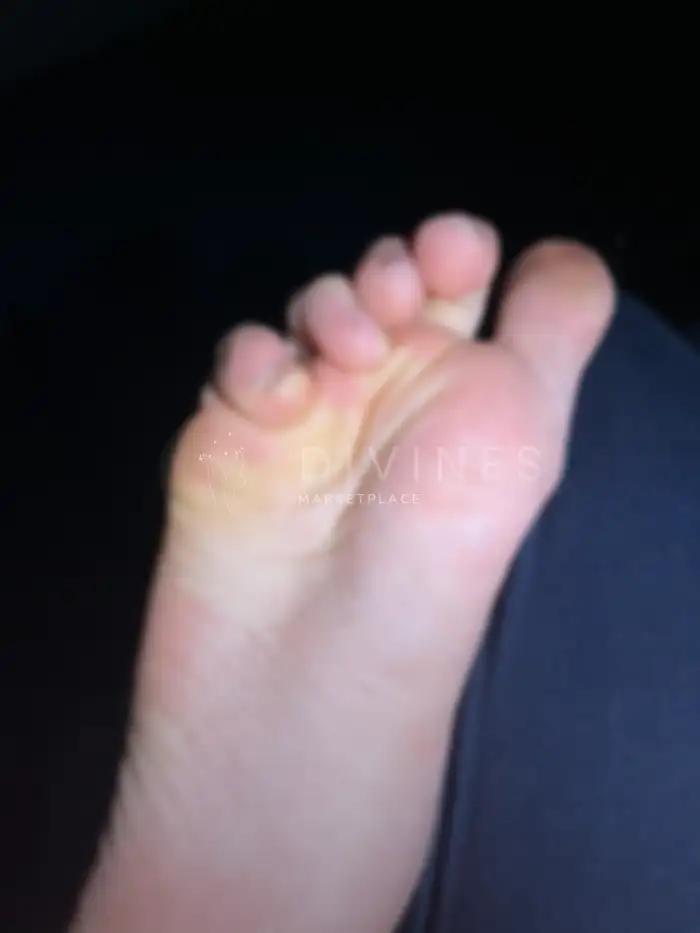 Pieds cadavre d’araignée